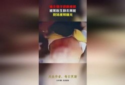 缅北医生爆料视频大全集,真实事件背后的惊心动魄